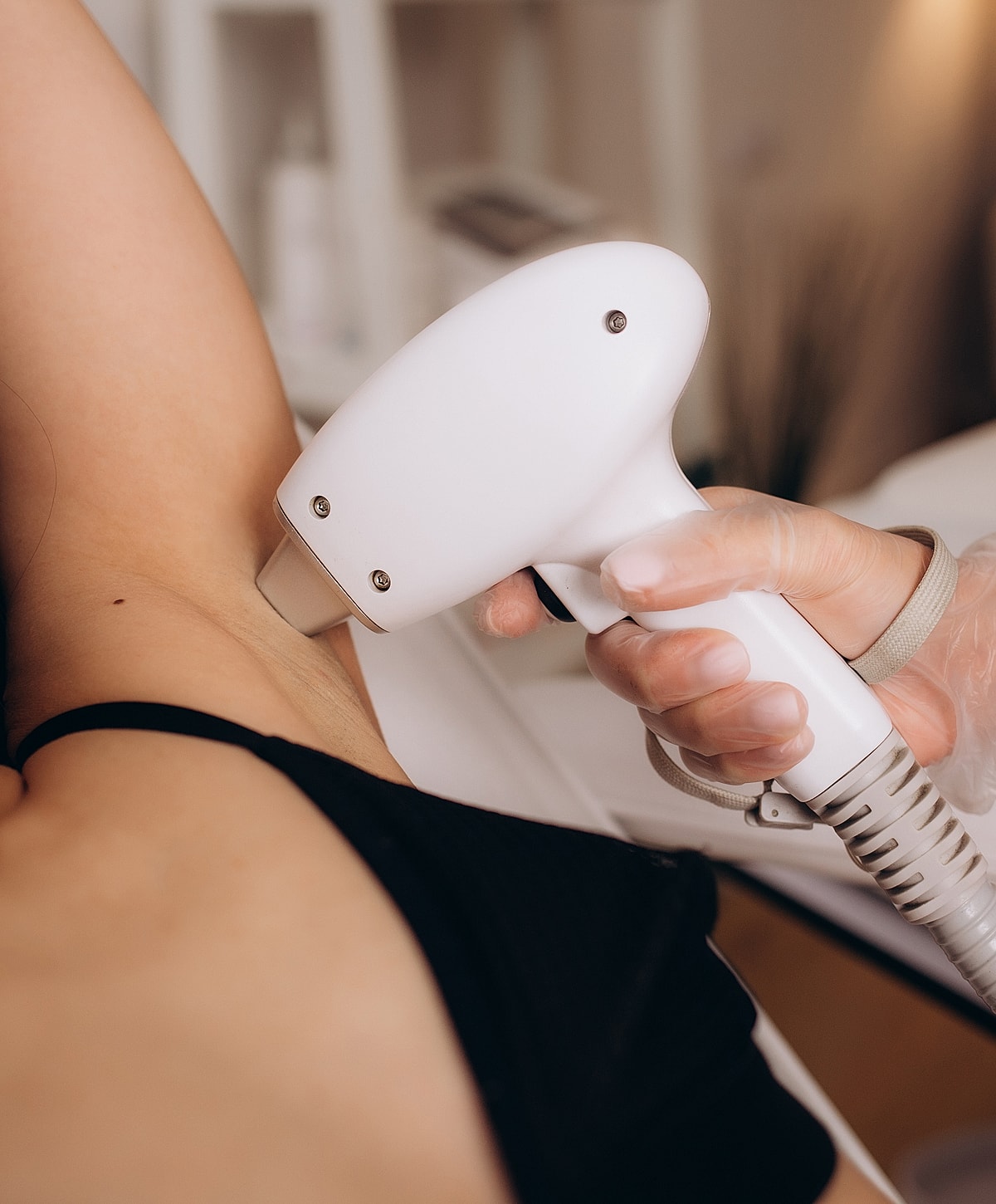 Laser hair removal treatment in progress.