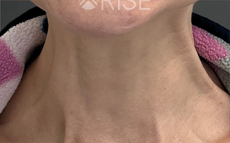 Medical Grade Skincare Before & After