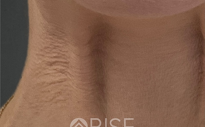 Medical Grade Skincare Before & After